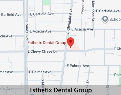 Map image for Dental Implants in Glendale, CA