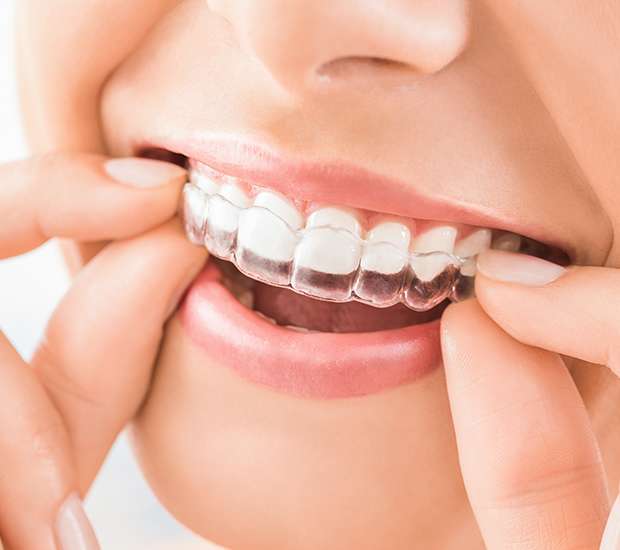 Glendale Does Invisalign Really Work